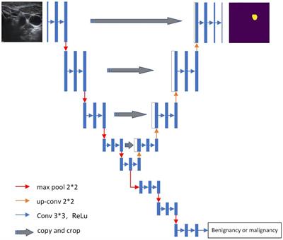 Deep learning-assisted ultrasonic diagnosis of cervical lymph node metastasis of thyroid cancer: a retrospective study of 3059 patients